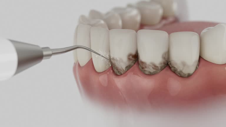 Reliable Dental contractor in Bayshore Gardens, FL by Dentist Open Now